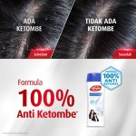 شامپو ضدشوره لایف بوی Lifebuoy anty ketombe 340ml - تصویر 4
